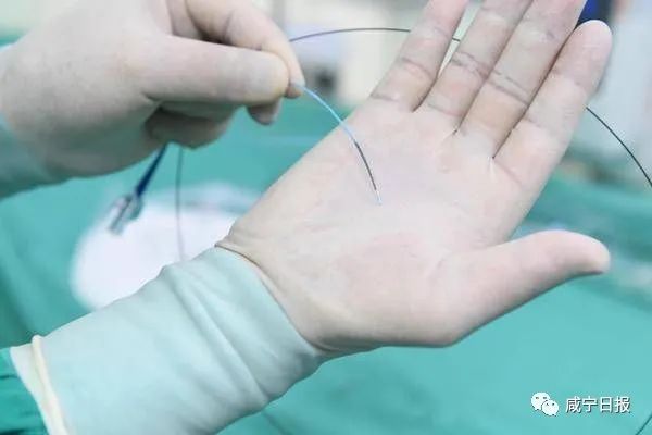 人均节省万余元！平价支架落地咸宁