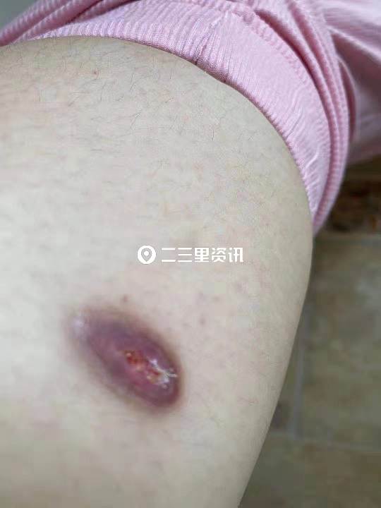 女子找技师做产后修复结果震惊了,女子找技师做产后修复结果气炸