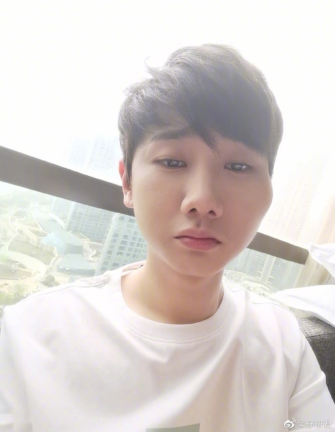汪苏泷脸摔肿,汪苏泷的脸摔肿了