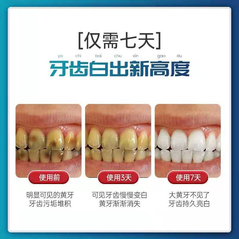 Qing调查|“7天就能黄牙变白牙”网红美白牙贴靠不靠谱?