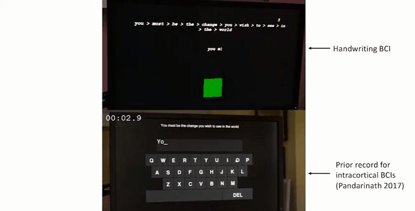截瘫患者「意念打字」登Nature封面：速度接近常人敲键盘，准确率99.2%