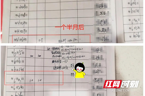 弱视视力提升需要什么训练,儿童弱视如何提高视力