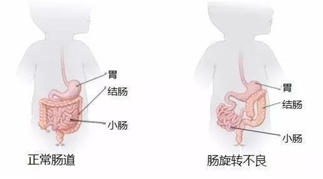 小孩出生第二天嘴里流出血,出生23天嘴里吐泡泡