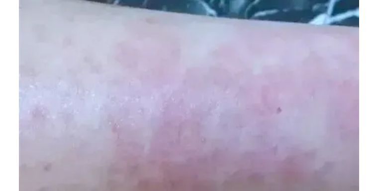 j-style脱毛仪,j-style脱毛仪怎么样