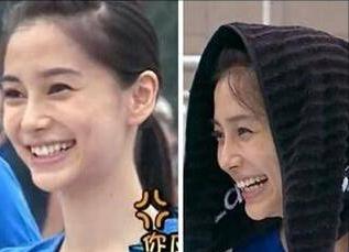 戴牙套矫正牙齿脸型会变好看吗,隐形牙套矫正后脸型变化