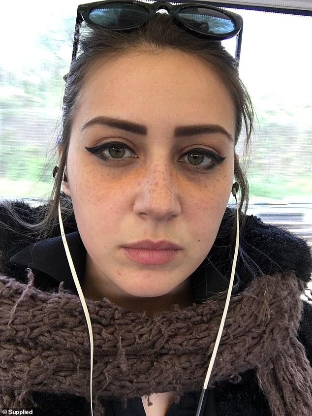 英女子痴迷梅根“雀斑妆”，拙劣手术让面部毁容，花3万治疗修复