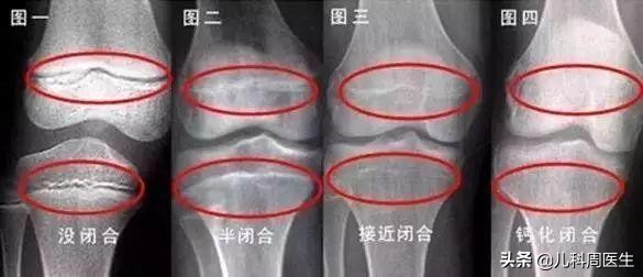 父母遗传矮怎么长高,身高被父母遗传怎么才能长高