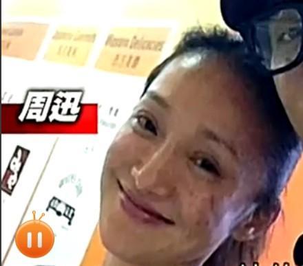 光了嫩肤后皮肤会变光滑吗,皮肤黑光子嫩肤10天变化图片