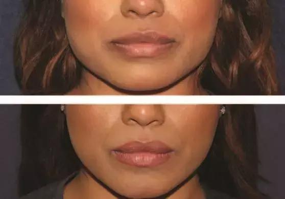 用简单的方法让脸变得更美,简单4个动作随时随地做让脸紧致