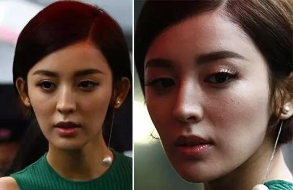 原来娜扎刘诗诗脸上的闭口这么严重!网传去闭口方法有没有用?