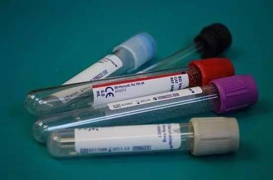 724肿瘤指标高二十倍是癌症吗,肿瘤指标199高一定是癌症吗