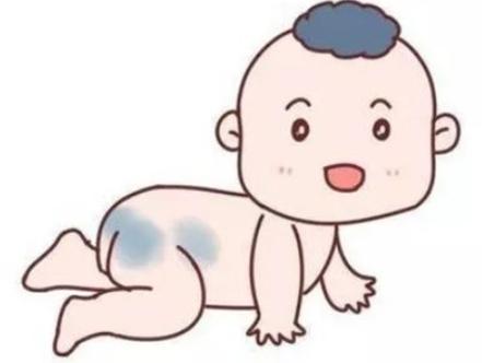 为啥宝宝身上会长胎记,青色胎记如何鉴别能否自行消退