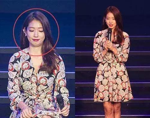 有没有解决双下巴的小物件,双下巴的福音来了