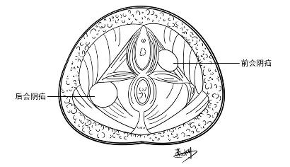 腹股沟疝有几种类型如何鉴别,腹股沟疝有哪些特点