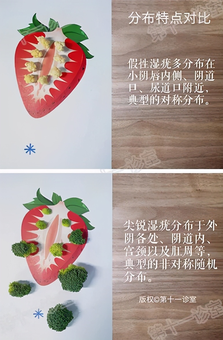 痛得合不拢腿、迈不开步，*处私**长的这东西到底是啥啊？