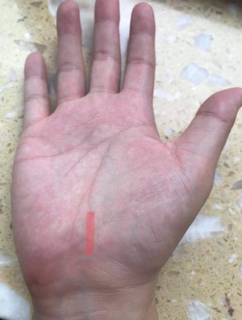 左手手指酸麻胀痛是什么病的前兆,手掌和手指酸麻疼痛是怎么回事