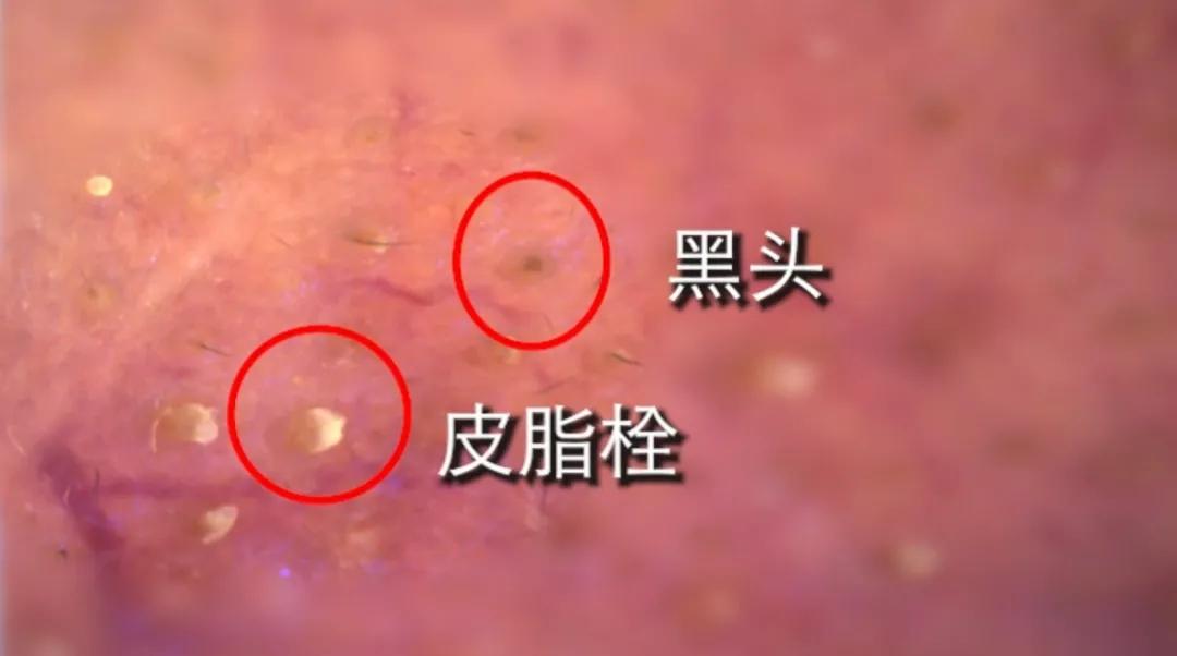 vt老虎清洁泥膜敏感肌能用吗,韩国vt老虎泥膜怎么用