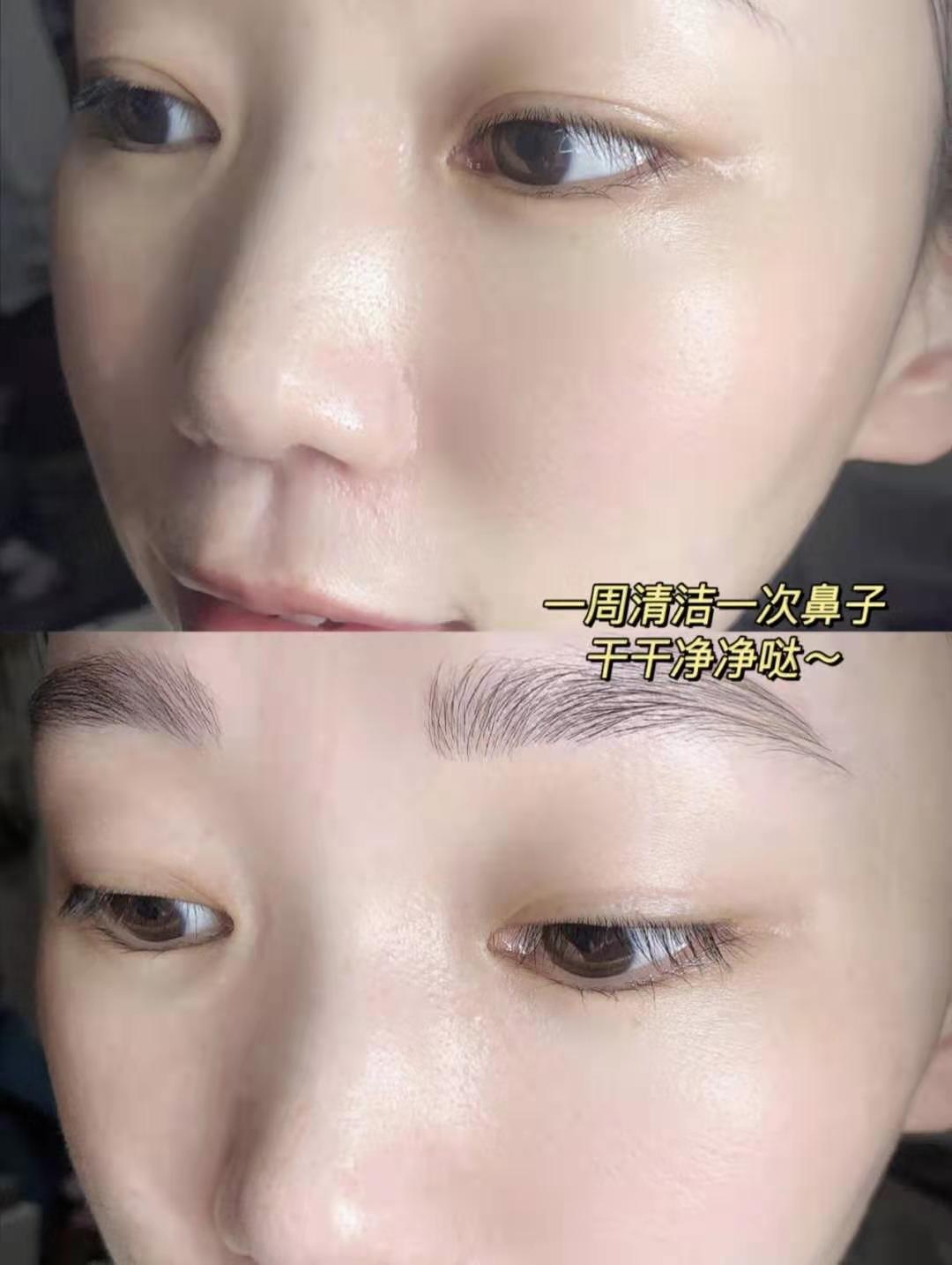 什么洗面奶去黑头收缩毛孔,去黑头收缩毛孔的最好方法小红书