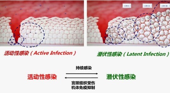 感染HPV，真的需要治疗吗？
