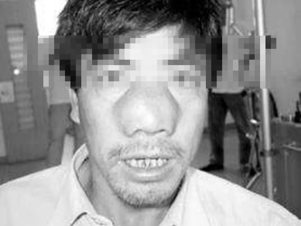 鼻炎长期鼻塞吃什么药,老鼻炎患者怎么治疗