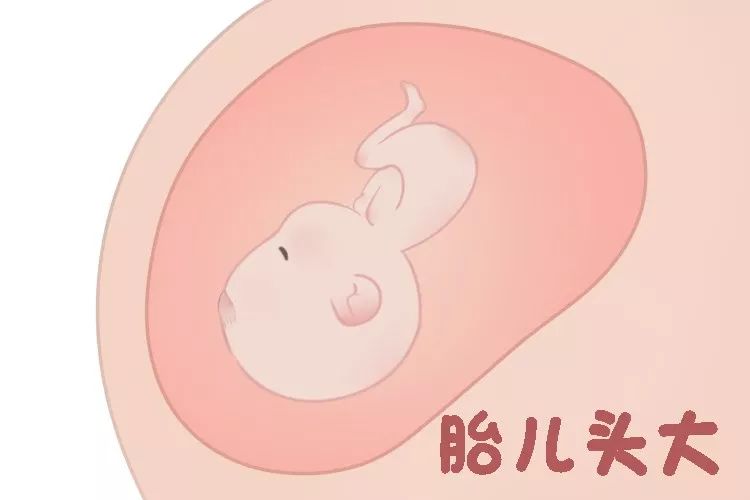 胎动异常胎儿缺氧可能性大吗,胎动异常感觉胎儿横位