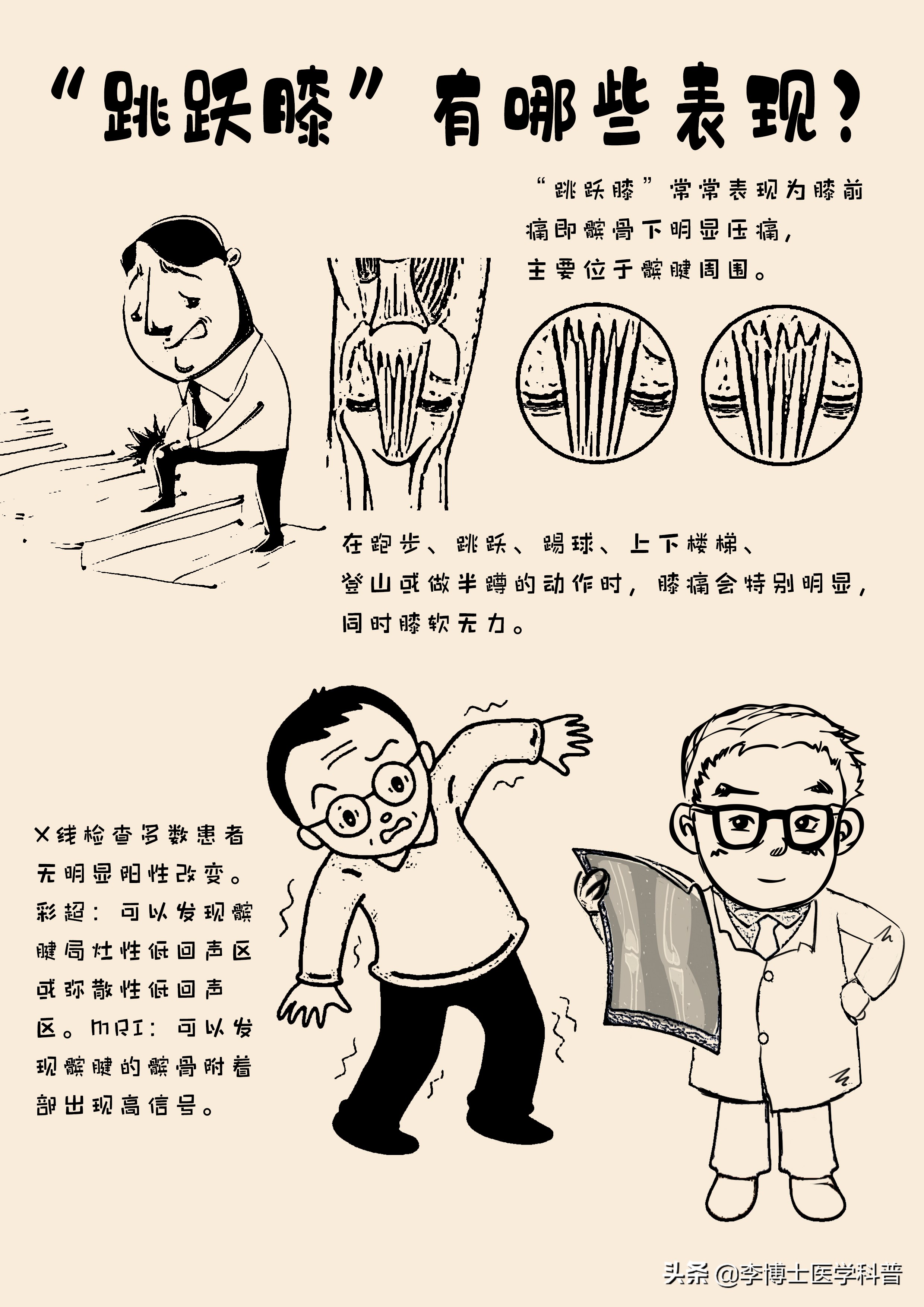 怎样缓解膝盖髌腱炎的疼痛,膝关节疼痛科普视频参赛作品