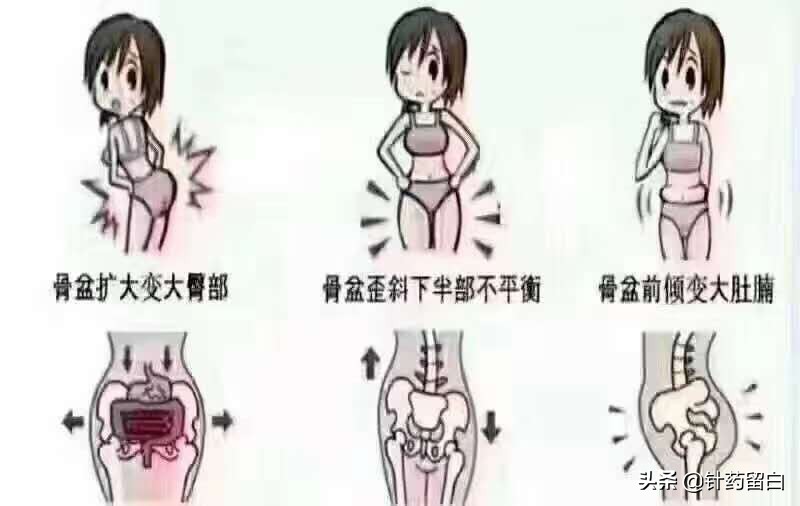 未婚女性盆底肌松弛漏尿怎么治疗,流产会导致盆底肌松弛漏尿吗