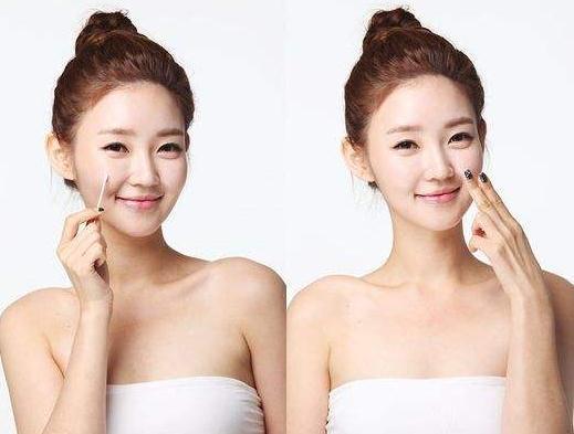 脸上的痘痘和粉刺的区别,女性常见的几种类型痘痘