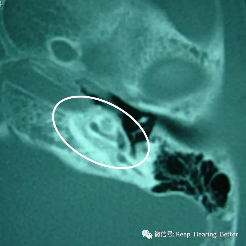 南大二附院,南大二附院耳鼻喉科专家