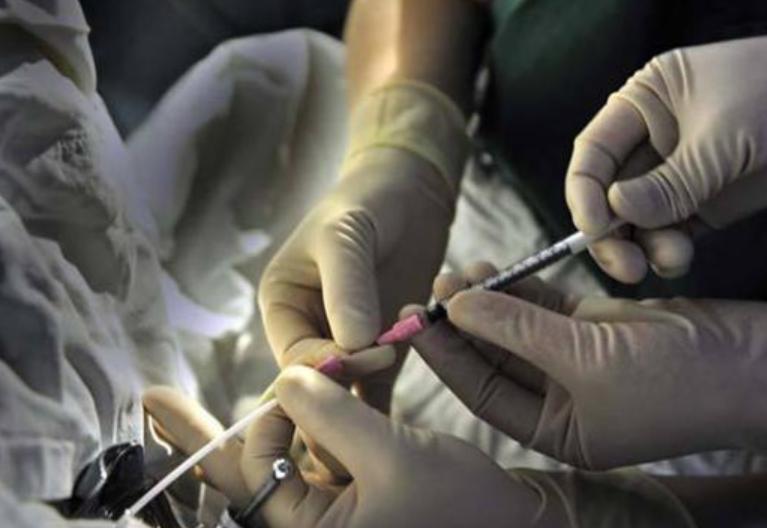 试管婴儿前必须要做人工授精吗,试管能观察卵子和精子结合吗