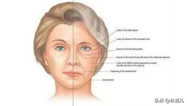 36岁的张钧甯“冻龄”人设不保?眼纹遮不住,周迅也有这个问题?