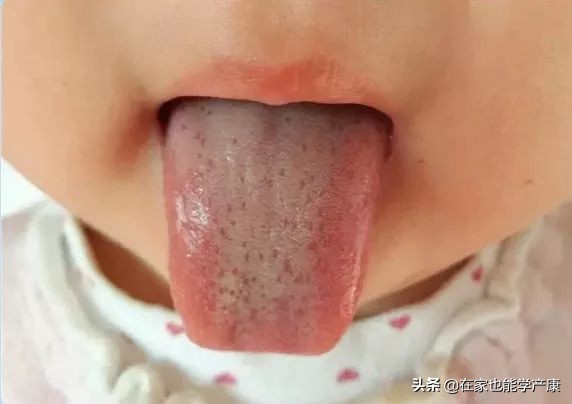 宝宝鹅口疮反复很烦人?试试小儿推拿手法,太有用了!