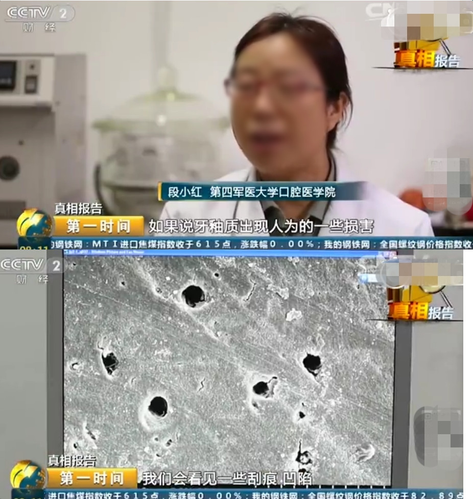 洗牙会伤害牙齿科普,洗牙会破坏牙保护膜么