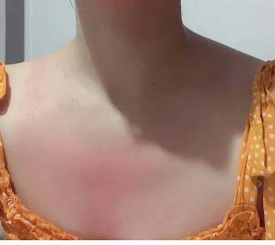 宋轶用的是什么保湿防晒喷雾 (宋轶防晒霜有多厉害)