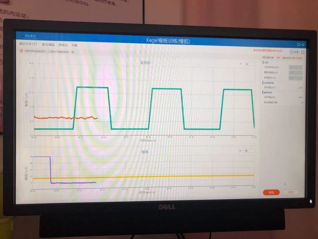 在医院盆底康复治疗,好消息先诊疗后付费