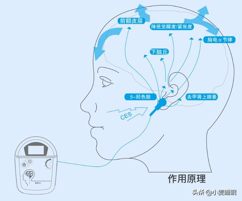 最新治疗抑郁症新药,最新中国上市的抑郁症新药