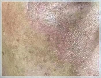 ​真是个“斑”脚石！（上集）