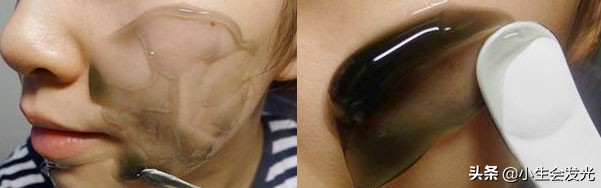 强力祛痘祛黑头,怎样祛鼻子黑头
