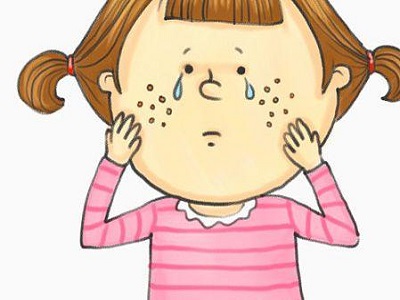 嘴巴周围长痘的解决方法青春期,嘴唇周围长痘原因是什么怎么治疗