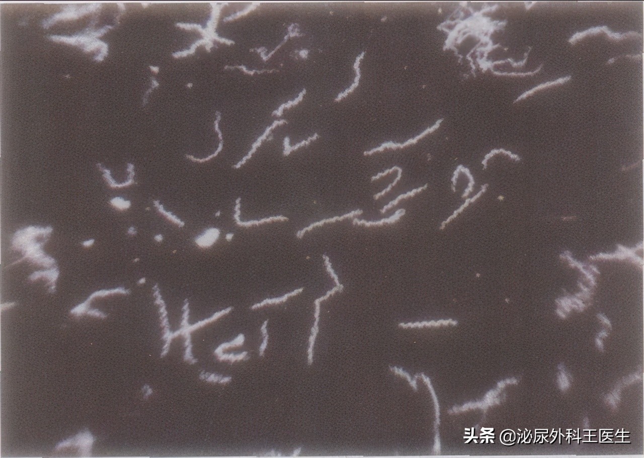 性病“梅毒”是如何横扫世界？