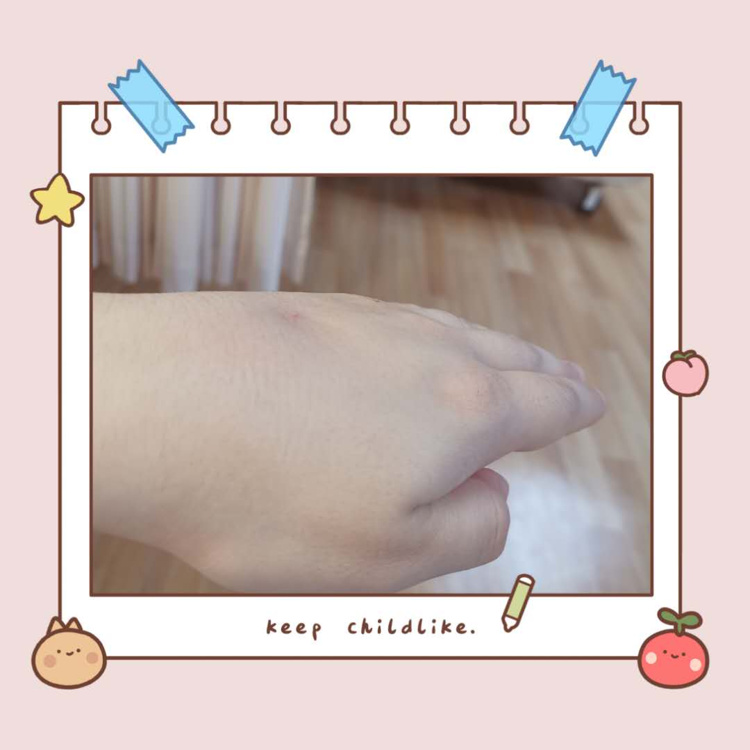 孕晚期检查胎儿头偏小怎么回事,孕晚期胎儿偏小最快解决方法