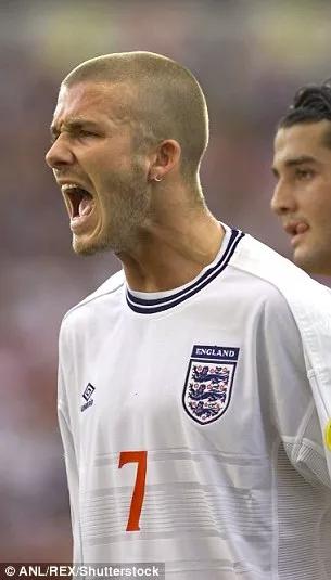 小贝为何剃光头,贝克汉姆的头秃