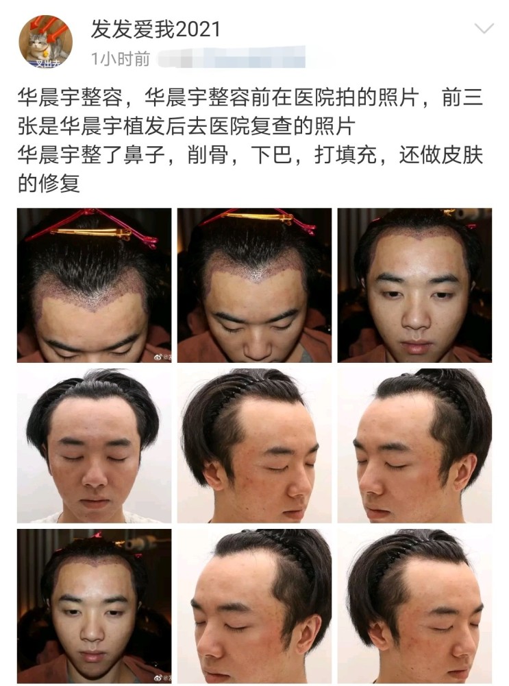 解析张碧晨华晨宇事件,网友评价华晨宇和张碧晨事件