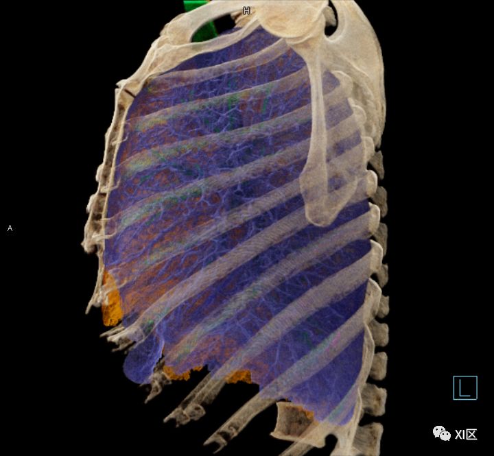 如此详细的肺部影像解剖，有点儿酷！