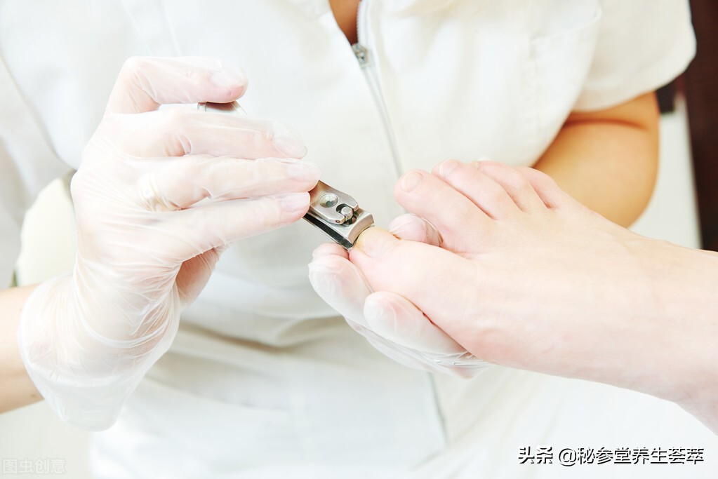 严重甲沟炎排脓放血,甲沟炎自行切开排脓