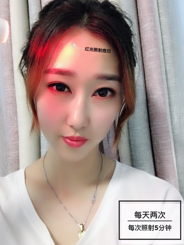 祛痘神器黑科技,祛痘黑科技美容仪