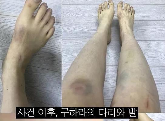 沉默后的具荷拉，沉默着的韩娱圈