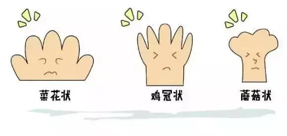 尖锐湿疣还有的救吗？看看这个案例