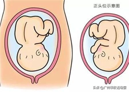 医生推荐孕期检查表,医生十月怀胎算法