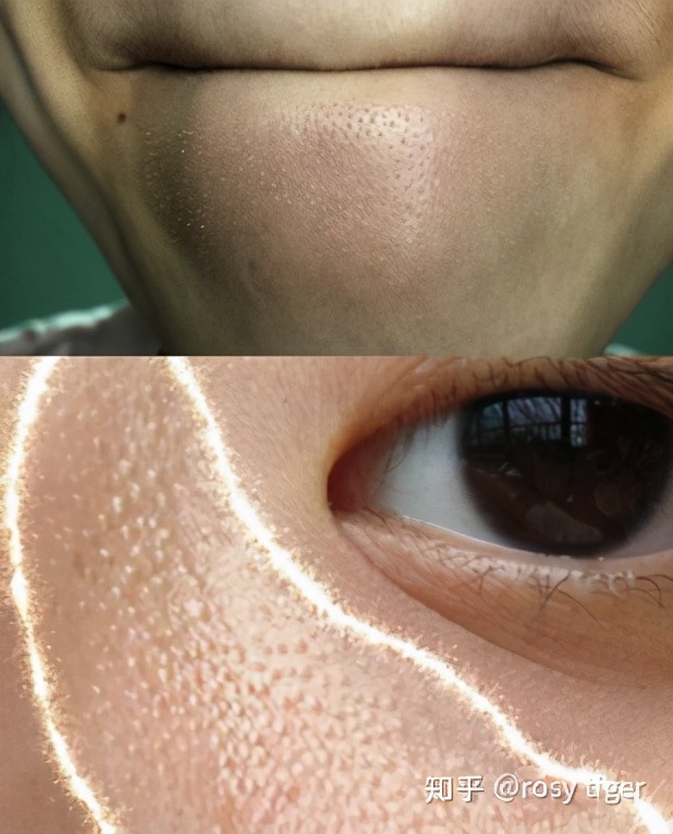 如何调理让皮肤变得光滑干净,怎样能使全身皮肤细腻白皙